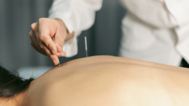 Acupuncture Services for Natural Healing and Wellness