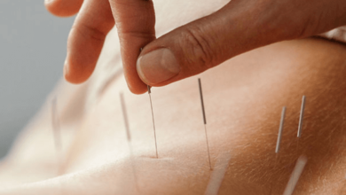 Acupuncture Services for Holistic Healing and Pain Relief