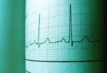 boost market pulse horizon 5405460395